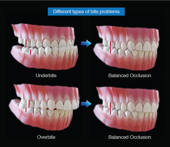 Emergency Care - McReynolds Orthodontics | Keller TX